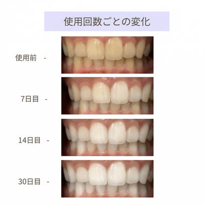 CEELIKE ホワイトニングシート｜過酸化物不使用。歯科医院級の白さを、自宅で・やさしく・30分で。