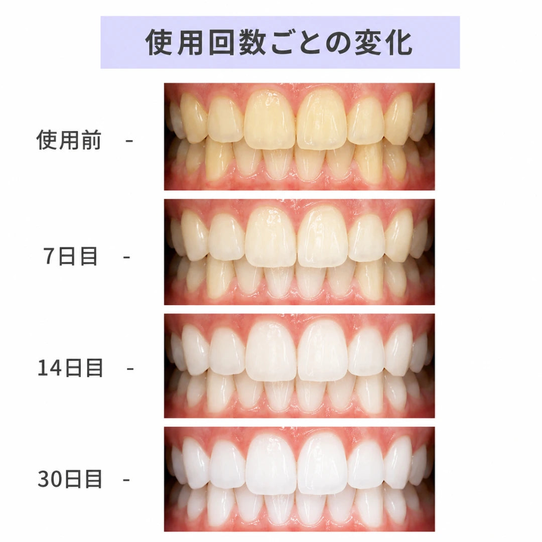 HAPstrip ホワイトニングシート｜過酸化物不使用。歯科医院級の白さを、自宅で・やさしく・30分で。